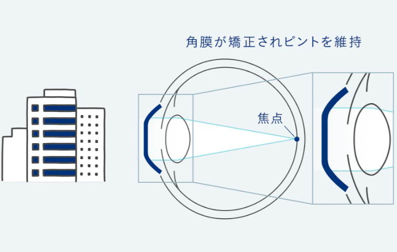 昼:レンズをはずした後
